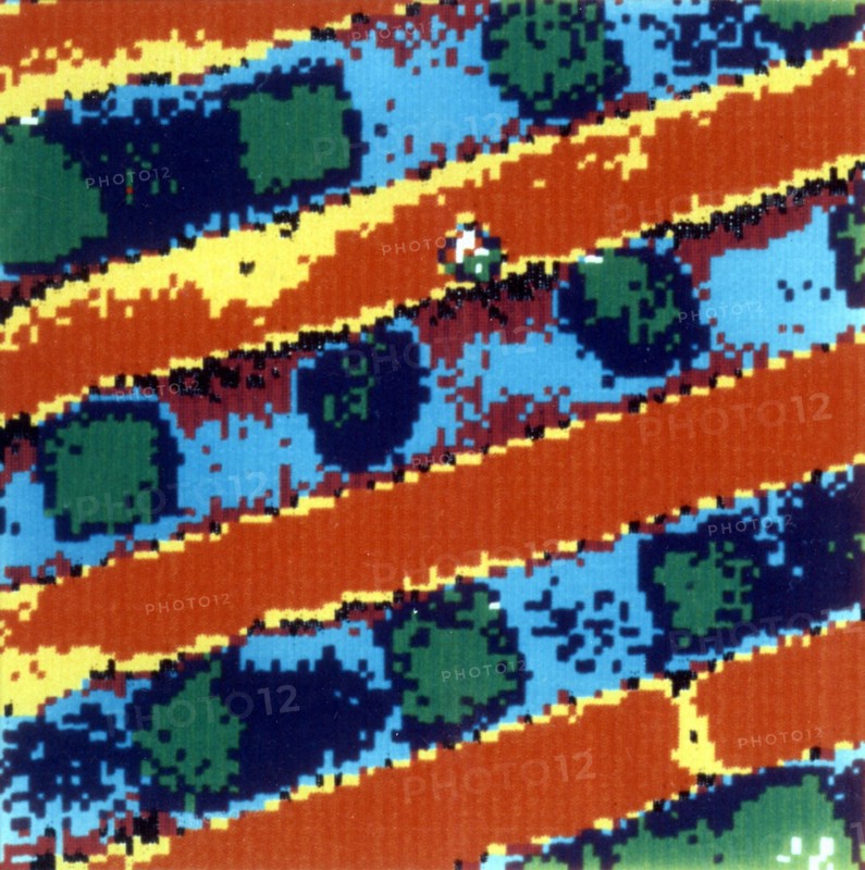 Image photoacoustique
