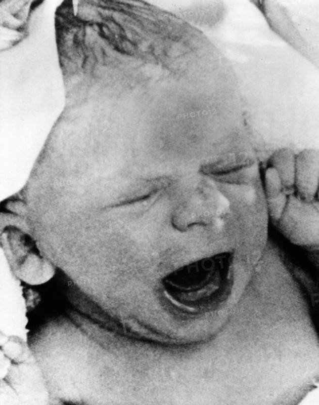 Louise Joy Brown, le premier bébé-éprouvette