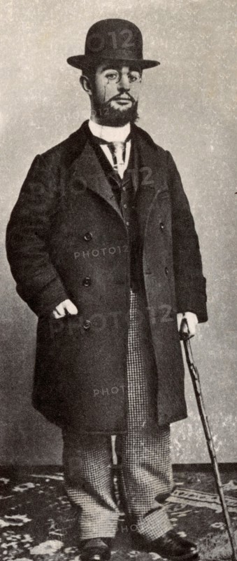 Henri de Toulouse-Lautrec (November 24, 1864 - September 9, 1901) was a French painter, printmaker, draughtsman and illustrator. He is among the most well-known painters of the Post-Impressionist period. His parents were first cousins and he suffered from