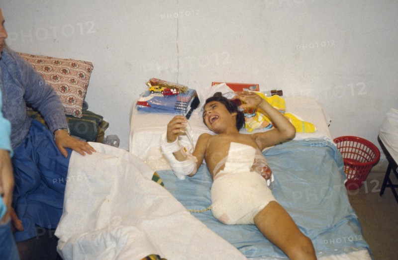 Un enfant victime de la guerre au Liban (1982-83)