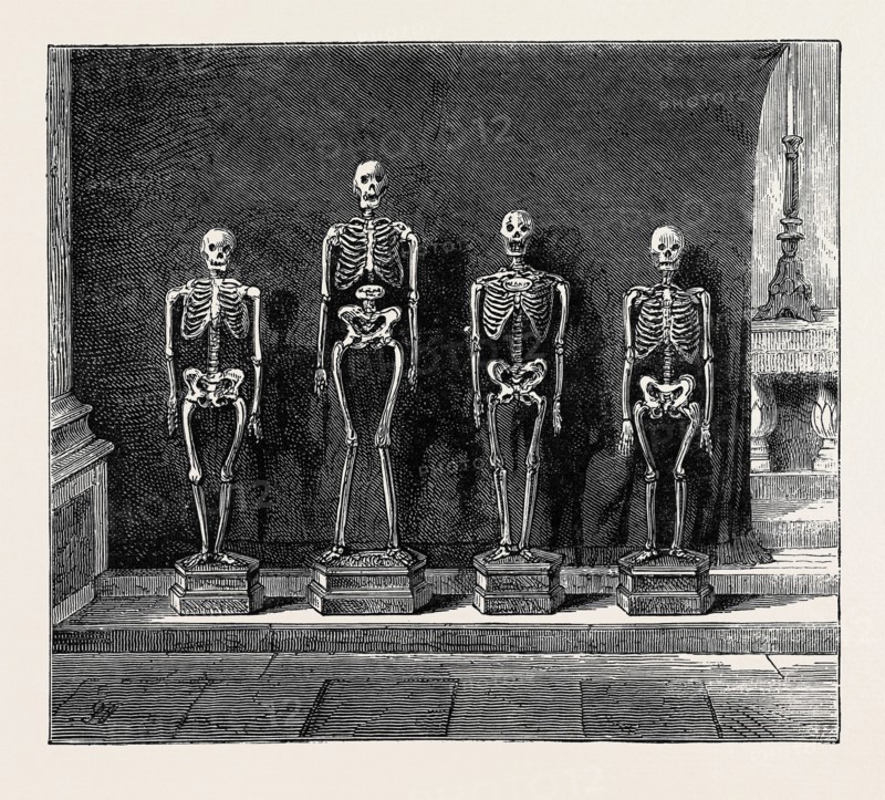 A VISIT TO THE BATTLEFIELD OF SOLFERINO: SKELETONS FOUND ON THE BATTLEFIELD