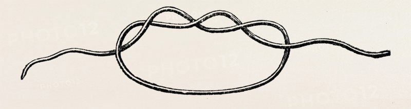first stage of the surgeon's knot, medical equipment, surgical instrument, history of medicine