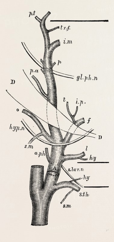 external carotid artery; natural size, modified from quain, medical equipment, surgical instrument, history of medicine