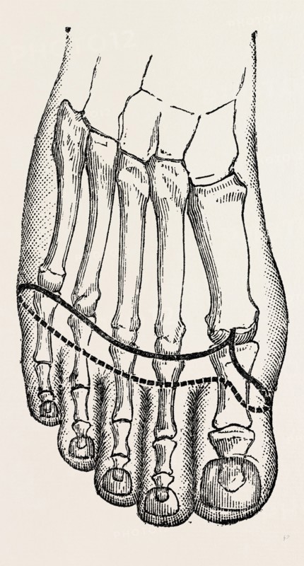 operation, medical equipment, surgical instrument, history of medicine