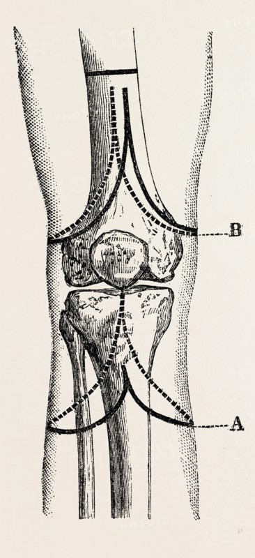 stephen smith's, medical equipment, surgical instrument, history of medicine