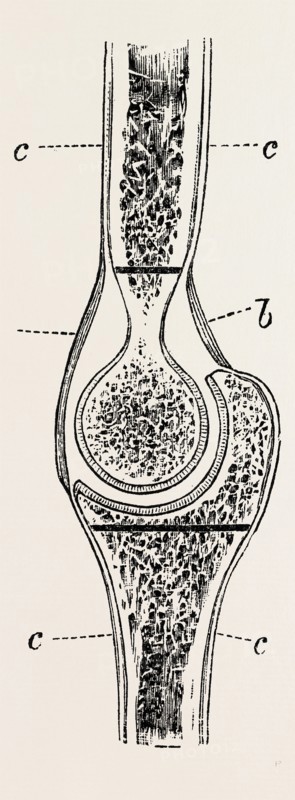diagrams to illustrate the sub-periosteal method of resection, medical equipment, surgical instrument, history of medicine