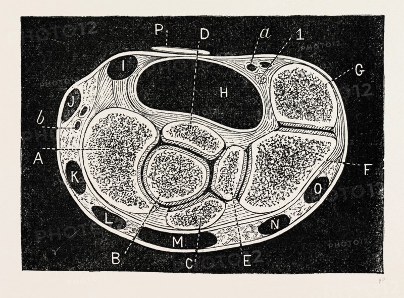 section through, medical equipment, surgical instrument, history of medicine