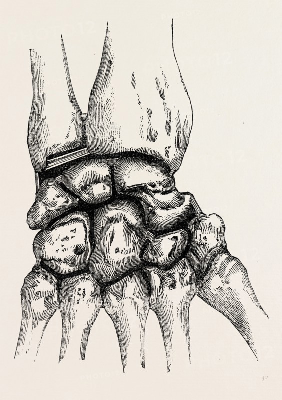 the synovial cavities, medical equipment, surgical instrument, history of medicine