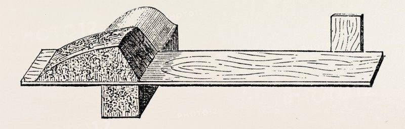 lister' s splint for excision, medical equipment, surgical instrument, history of medicine