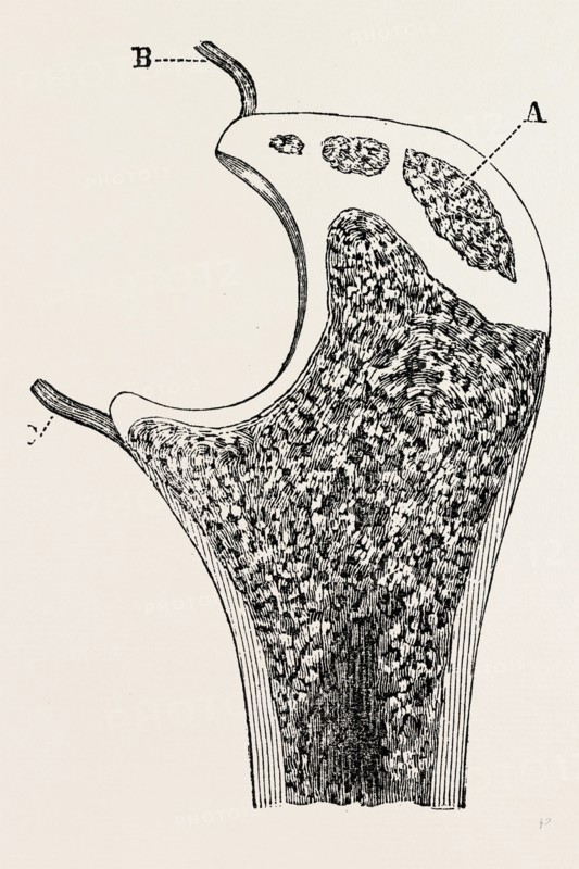 end of the ulna, medical equipment, surgical instrument, history of medicine
