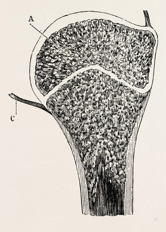 upper end of the humerus, medical equipment, surgical instrument, history of medicine