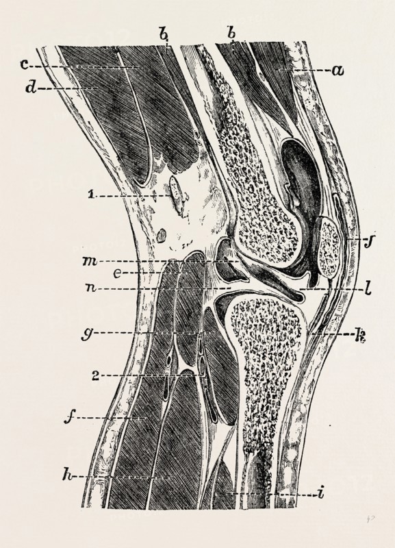 vertical section of knee-joint, medical equipment, surgical instrument, history of medicine