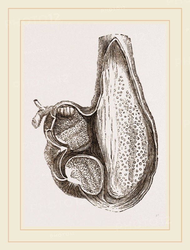 Stomach of Ostrich laid open