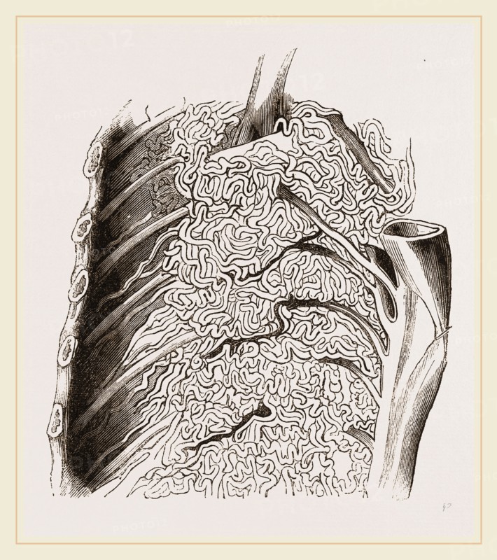 Vascular Apparatus of Whale