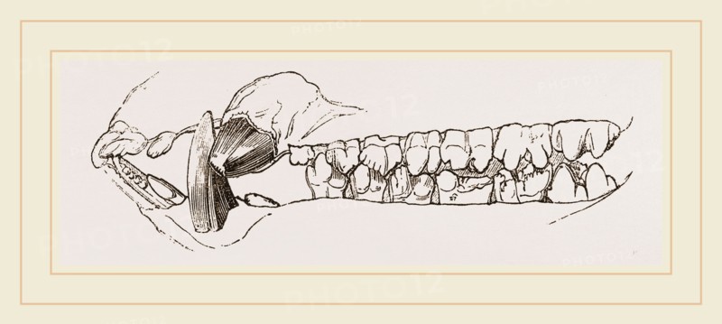 Teeth of the Hog
