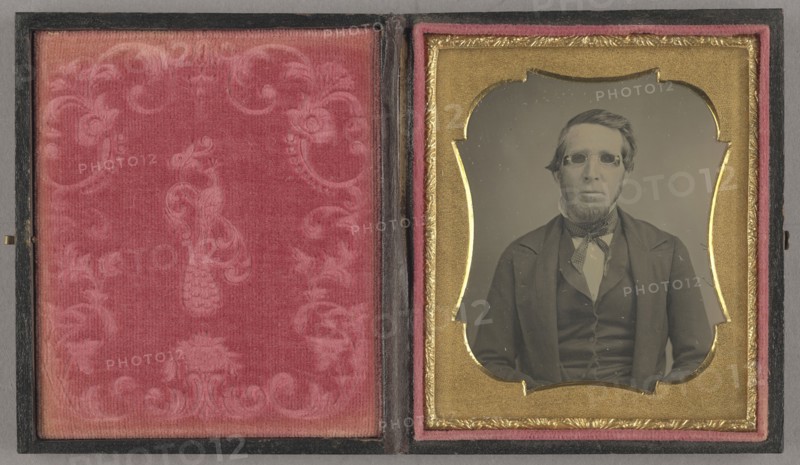 Portrait of a Seated Man Wearing Dark Glasses with Blinders; American; about 1858; Daguerreotype