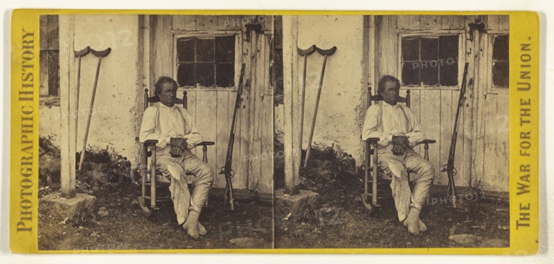 John L. Burns, the old Hero of Gettysburgh, recovering from his wounds; Studio of Mathew B. Brady, American, about 1823 - 1896