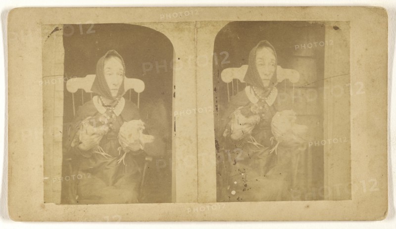 Nancy Luce the hen woman; James W. Warren, American, active 1860s, about 1865; Albumen silver print
