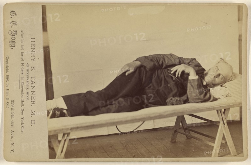 Henry S. Tanner, MD; G.E. Hogg, American, active New York, New York 1880s, 1880; Albumen silver print