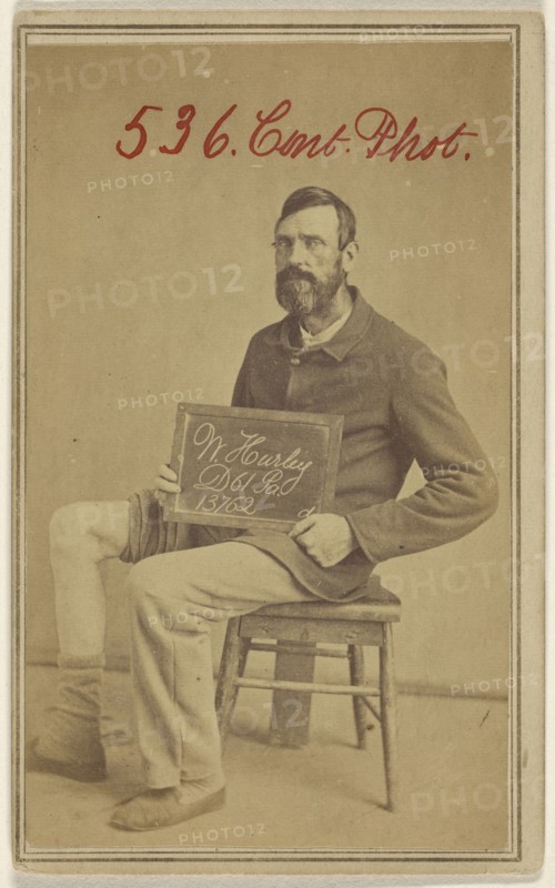W. Hurley, D 61 Pa. 13762. Civil War victim; Attributed to William H. Bell, American, 1830 - 1910, 1862-1864; Albumen silver