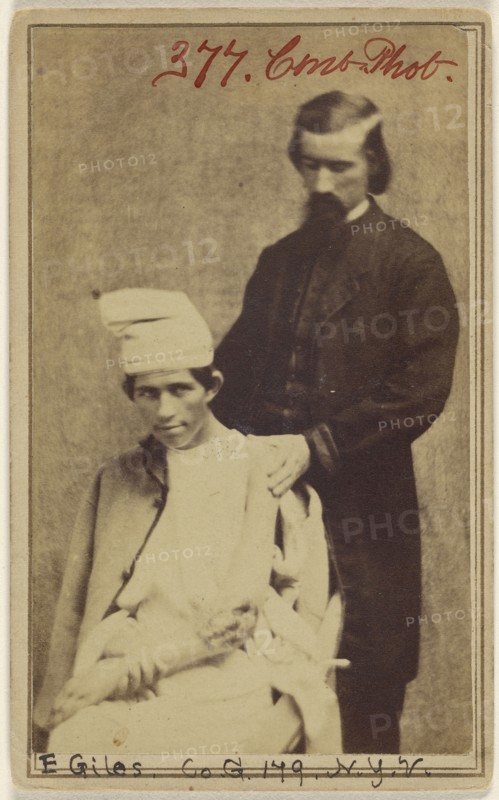 Edward Gyles Pvt. Co. G. 179 N.Y.V. resection elbow joint in Field recovery; Attributed to William H. Bell, American, 1830