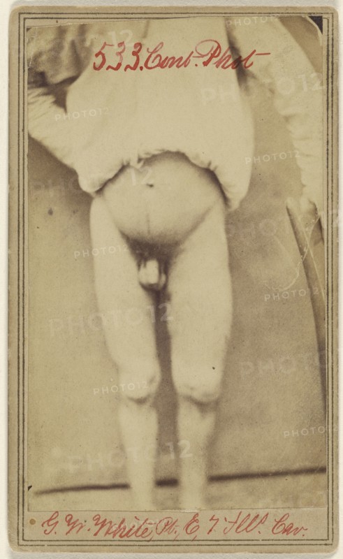 Geo. W. White Pri. Co. E. 7. Ill. Cav. age 25...Civil War victim; Attributed to William H. Bell, American, 1830 - 1910, April