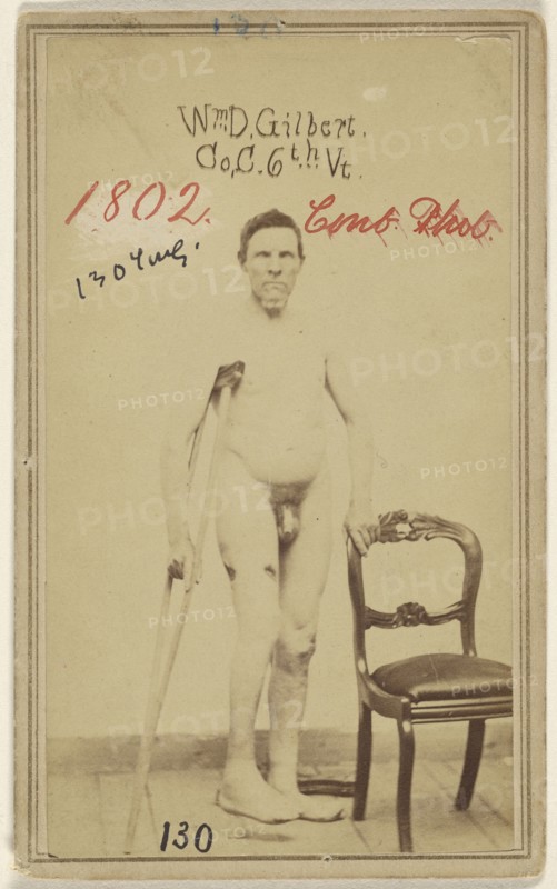 Wm. D. Gilbert Co. C. 6th Vt. Civil War victim; American; 1862 - 1868; Albumen silver print