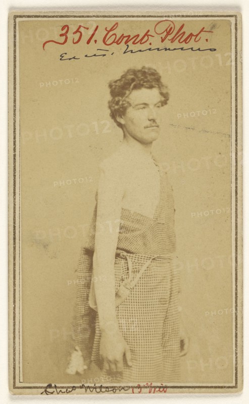 Chas. Wilson Civil War victim; Baldwin & Prior, American, 1865 - 1867, 1865 - 1867; Albumen silver print