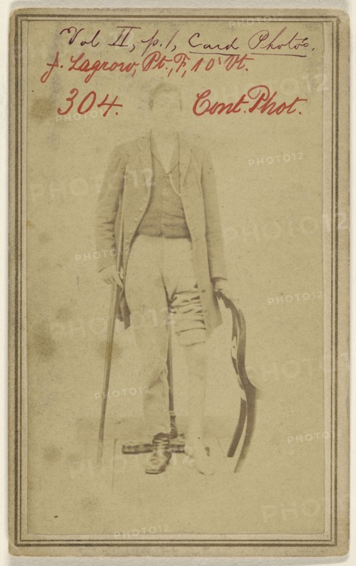 Joseph Lagrow, Pt. F. 10th Vt. Civil War victim; American; 1865 - 1867; Albumen silver print
