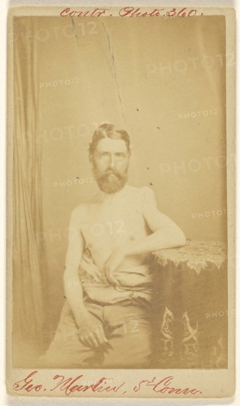 Geo. Martin, 5th Conn. Civil War victim; S. Friedlaender, American, active 1860s, 1864 - 1866; Albumen silver print