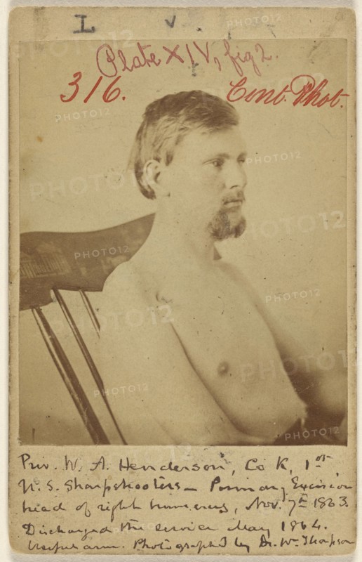 Priv. W.A. Henderson, Civil War vicitim; W. Thompson, American, active 1860s, May 1864; Albumen silver print