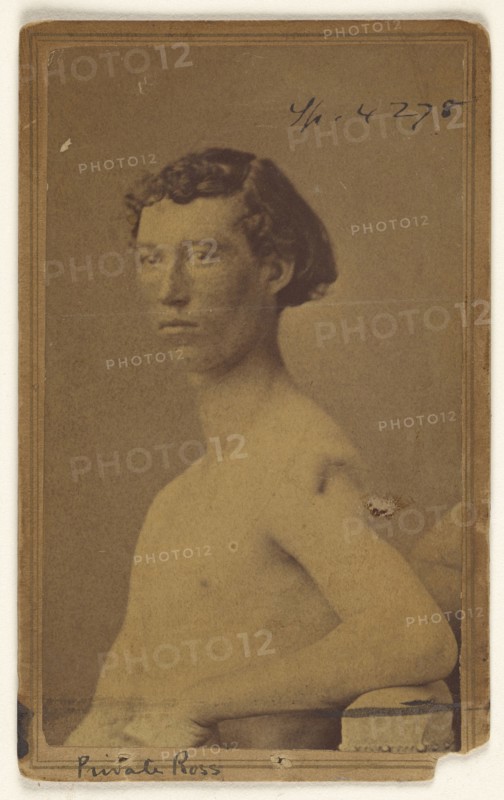 Private Ross Civil War victim; Attributed to William H. Bell, American, 1830 - 1910, 1865-1874; Albumen silver print