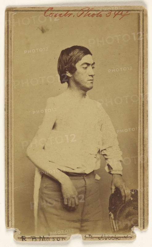 Russell B. Mason, Civil War victim; Baldwin & Prior, American, 1865 - 1867, about 1864; Albumen silver print