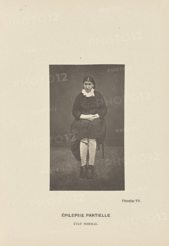 Épilepsie Partielle État Normal; Paul-Marie-Léon Regnard, French, 1850 - 1927, Paris, France; 1878; Photogravure; 10.2 × 6.1 cm