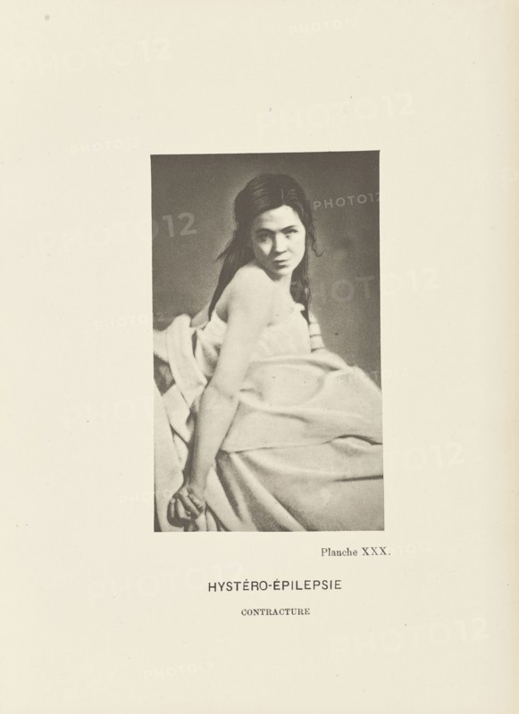 Hystero-Epilepsy Contraction; Paul-Marie-Léon Regnard, French, 1850 - 1927, Paris, France; 1878; Photogravure; 10.3 × 6.2 cm