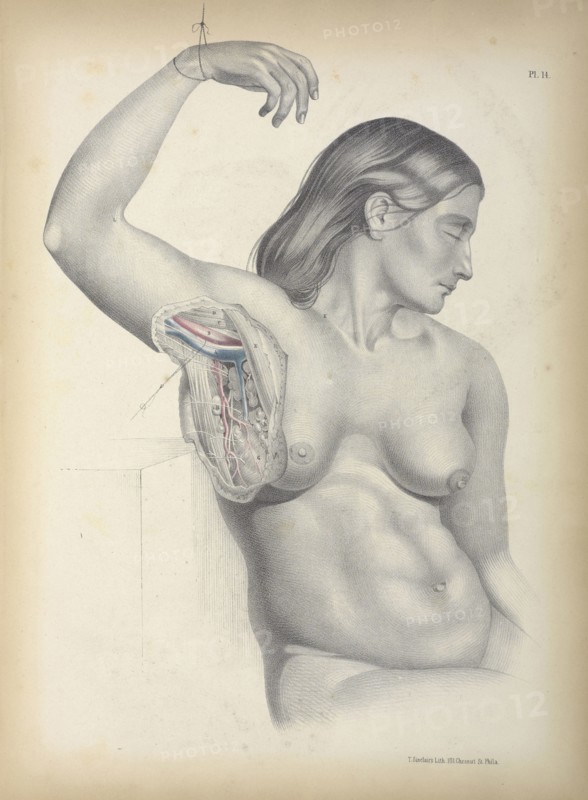 Pl. 14, Surgical anatomy, Maclise, Joseph, Lithography, 1851, Colored lithograph. Maclise is the author and illustrator