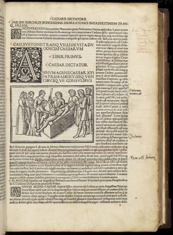 Leaf, 5, recto with illustration depicting Julius Caesar's birth by caesarian section, Suetonius Tranquillus cum Philippi