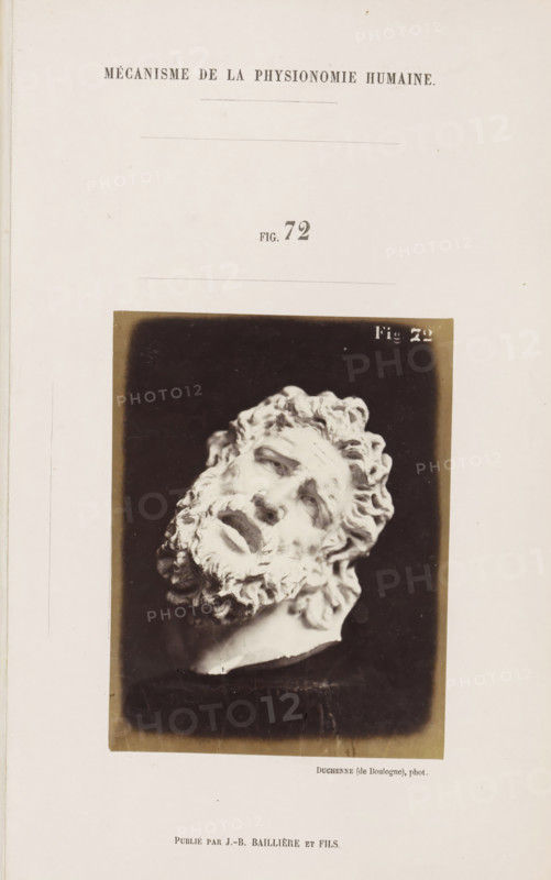 Image of 'Laocoon de Bruxelles', photograph, page, Unnumbered page with photo 72 from Mécanisme de la physionomie humaine ou analyze électro-physiologique de l'expression des passions (Atlas)., photographer: Guillaume Benjamin Amand Duchenne, France, publisher: JB Baillière et Fils, Paris, c. 1860 - in or before 1862, Guillaume Benjamin Amand Duchenne, JB Baillière et Fils, photographer, publisher, paper, albumen print, albumendruk, height 119 mm x width 91 mm, piece of sculpture, reproduction of a piece of sculpture, experiment, test, science and technology, face, morphology of facial expression, physiology and anatomy, physiognomy, nervous system, neurology, A vertical page with a large rectangular photograph centered on the lower half, showing a close-up of a sculpted male head with curly hair and a full beard tilted to the side, eyes partially closed and mouth slightly open, set against a dark background and framed by a lighter margin, with the surrounding page showing pale blank s...