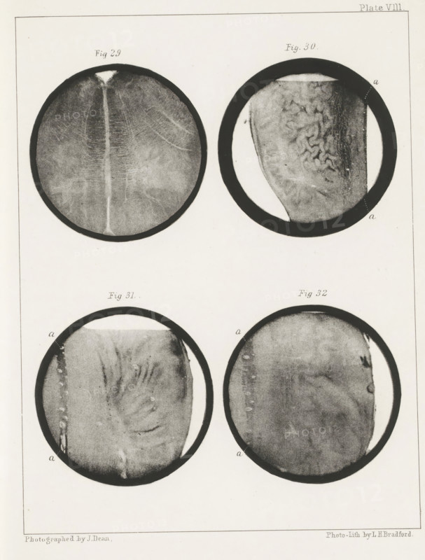 Four longitudinal and transverse sections of a human medulla oblongata, page, photomechanical print, number: 'Plate VIII. Fig. 29. Fig 30. Fig. 31. Fig. 32.', photographer: John Dean, printmaker: Bradford & Co, LH, c. 1854 - in or before 1864, paper, photolithography, height 301 mm x width 230 mm, brains, Four circular photographic images are arranged in a grid with two across and two down, each framed by a dark ring against a pale background. The top left circle shows a grainy, textured surface with a central vertical lighter band and subtle radiating lines. The top right circle contains a textured surface with irregular ridges and folds on one side and a vertical darker band along the rim. The bottom left circle displays a softer, mottled texture with curved striations and a lighter vertical streak near one edge. The bottom right circle features a diffuse, cloudy surface with uneven shading and a few darker spots near the perimeter. The surrounding page shows a thin rectangular borde...