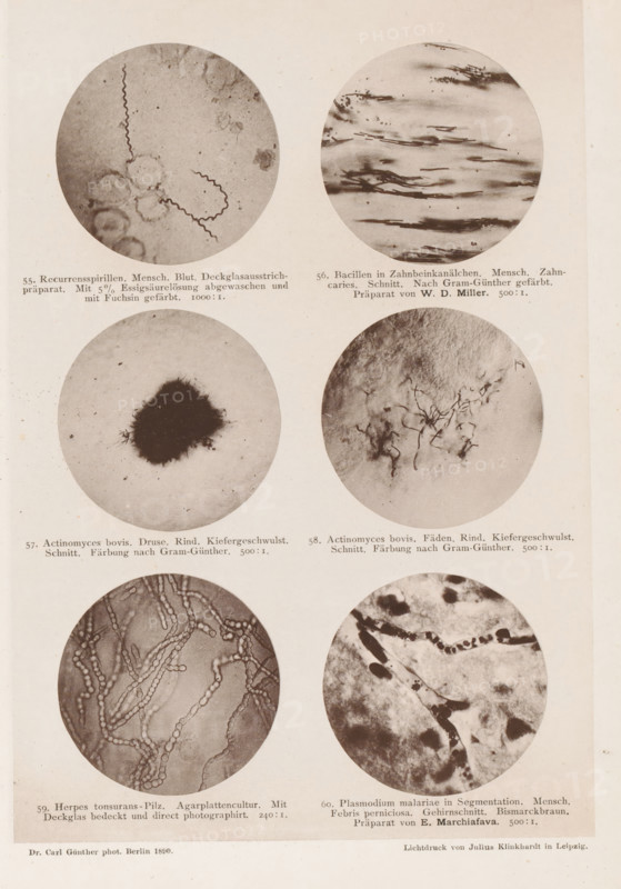 Six microscope images of bacteria, page, photomechanical print, number: 'Tafel X.', inscription: '55. Recurrence spirals. Mensch. Broke. Deckgalsausstrichpräparat. With 5% cleaning and cleaning done. 1000:1. 56. Bacilli in Zahnbeinkanälchen. Mensch. Zahncaries. Schnitt. Nach Gram-Günther gefärbt. Präparat von WD Miller. 500:1. 57. Actinomyces bovis. Druse. Rind. Kiefergeschwulst. Schnitt. Farbung nach Gram-Günther. 500:1. 58. Actinomyces bovis. Faden. Rind. Kiefergeschwulst. Schnitt. Farbung nach Gram-Günther. 500:1. 59. Herpes tonsurans-Pilz. Agarplattencultur. With deck glass covered and direct photography. 240:1. 60. Plasmodium malariae in Segmentation. Mensch. Febris perniciosa. Gehirnschnitt. Bismarckbraun. Präparat von E. Marchiafava. 500:1.', photographer: Carl Günther, Berlin, maker: Friedrich Julius Klinkhardt, Leipzig, c. 1880 - in or before 1890, Saxony, paper, collotype, photoprint, height 242 mm x width 165 mm, Prints in section at the back., unicellular animals, bacteria,...