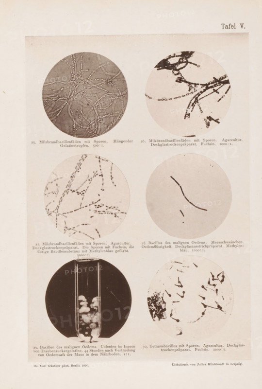 Six microscope images of bacteria, including the anthrax bacterium, page, photomechanical print, number: 'Tafel V.', inscription: '25. Milzbrandbacteriadenfaeden mit Sporen. Hängender Gelatintropfen. 500:1. 26. Milzbrandbacillienfäden mit Sporen. Agar culture. Deckglassrockenpräparat. Fuchsin. 1000:1. 27. Milzbrandbacillienfäden mit Sporen. Agar culture. Deckglassrockenpräparat. Die Sporen mit Fuchsin, die übrige Bacillensubstanz mit Methylenblau gefärbt. 1000:1. 28. Bacillus des maligen Edemas. Meerschweiden. Edema fluidity. Deckglasausstrichpräparat. Methylenblau. 1000:1. 29. Bacilli de malignant Edema. Colonien im Innern von Traubenzuckergelatine, 44 Stunden nach Vertheilung von Oedemsaft der Maus in dem Nährboden. 1:1. 30. Tetanus bacillus with spores. Agar culture. Deckglassrockenpräparat. Fuchsin. 1000:1..', photographer: Carl Günther, Berlin, maker: Friedrich Julius Klinkhardt, Leipzig, c. 1880 - in or before 1890, Saxony, paper, collotype, photoprint, height 242 mm x width 165 ...