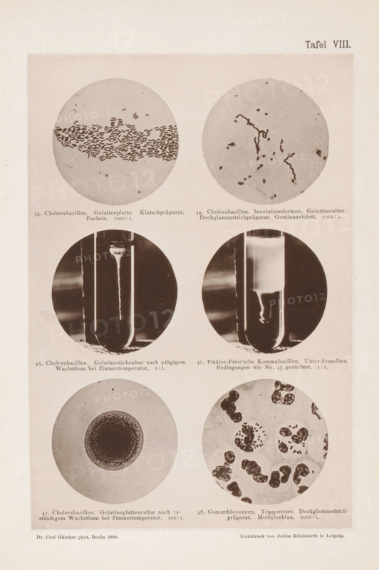 Six microscope images of bacteria, including the cholera bacterium, page, photomechanical print, inscription: '43. Cholera bacilli. Gelatin platter. Klatschpräparat. Fuchsin. 1000:1. 44. Cholera bacilli. Involutionsforms. Gelatin culture. Deckglasausstrichpräparat. Gentianaviolett. 1000:1. 45. Cholera bacilli. Gelatin stick culture after 9 hours of warm weather. 1:1. 46. Finkler-Prior'sche Comma bacilli. Unter denselben Bedingungen wie No. 45 sighs. 1:1. 47. Cholera bacilli. Gelatin plattenculture after 72-stündigem Wachsthum at Zimmertemperatur. 100:1. 48. Gonorrheacocci. Trippereiter. Deckglasausstrichpräparat. Methylenblau. 1000:1.', number: 'Tafel VIII.', photographer: Carl Günther, Berlin, maker: Friedrich Julius Klinkhardt, Leipzig, c. 1880 - in or before 1890, Carl Günther, Friedrich Julius Klinkhardt, photographer, Saxony, paper, collotype, photoprint, height 242 mm x width 165 mm, Prints in section at the back., unicellular animals, bacteria, bacilli, A vertical page with a pa...