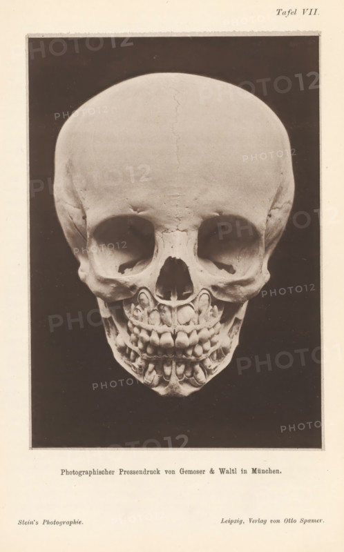Children's skull with alternating teeth, page, photomechanical print, number: 'Tafel VII.', cliché maker: Gemoser & Waltl, Cologne, c. 1867 - in or before 1877, Gemoser & Waltl, photographer, cliché maker, North Rhine-Westphalia, paper, collotype, photoprint, height 145 mm x width 101 mm, (human) skull, teeth, A photograph shows a human skull facing forward against a dark rectangular background framed by a lighter border; the skull has a smooth rounded forehead with visible sutures, deep eye sockets, a nasal cavity, and an upper and lower jaw with visible teeth and dental structures, with the overall image centered on the skull and surrounded by a pale margin.