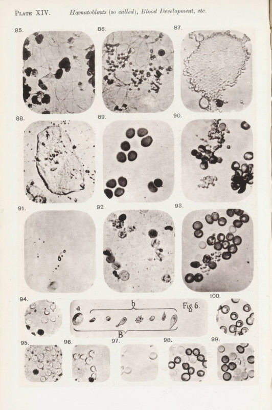 Eleven enlargements of blood corpuscles and fibrin and a diagram, page, photomechanical print, number: 'Photo. 85., Photo. 100.', number: 'Pl. XIV.', photographer: Richard Norris, cliché maker: anonymous, c. 1872 - in or before 1882, paper, collotype, photoprint, height 213 mm x width 135 mm, Page opposite page 215., blood, statistic diagram, graph, pictorial chart, A vertical page showing a grid of rounded-square photographic panels arranged in rows, each panel containing close-up microscopic images of various circular and irregular cell-like shapes and granules on pale backgrounds; the images vary in contrast with some showing dense clusters of dark, rounded discs, others showing lighter textured masses with scattered small particles, and a few showing chains or aggregations of tiny specks; a small horizontal diagram with elongated sketches appears near the lower middle of the page flanked by additional circular close-ups, and the overall page has a light margin with faint edge wear.