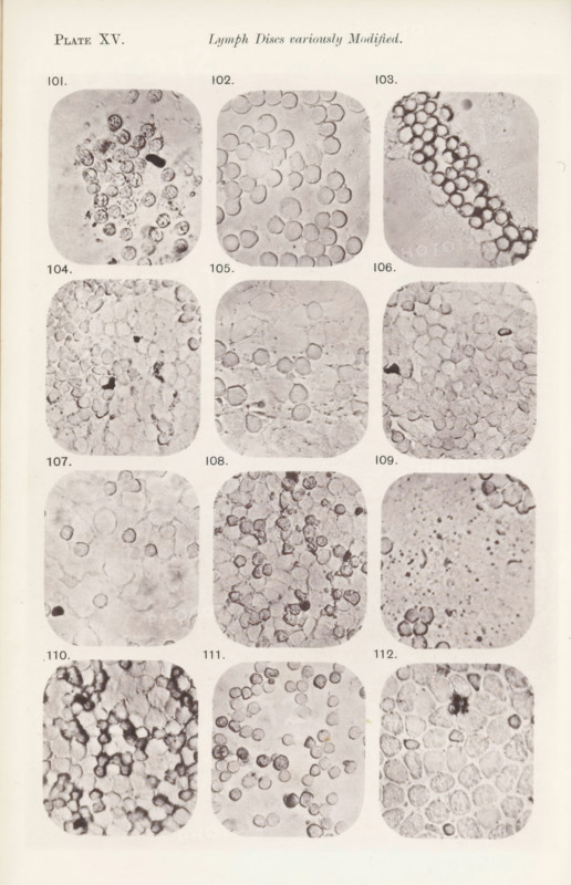 Twelve enlargements of lymphocytes, page, photomechanical print, number: 'Pl. XV.', number: 'Photo. 101., Photo. 112.', photographer: Richard Norris, cliché maker: anonymous, c. 1872 - in or before 1882, paper, collotype, photoprint, height 213 mm x width 135 mm, Page opposite page 217., blood, A vertically oriented page showing a grid of rounded-rectangle photographic panels arranged in three columns and multiple rows, each panel containing close-up grayscale microscopic images of numerous circular and irregular cell-like structures with varying textures and densities; the panels display clusters and strands of small round forms, some appearing hollow or with darker centers, others tightly packed or loosely scattered against pale to mottled backgrounds, with occasional darker irregular specks and thin fibrous lines visible in several panels; the overall page has a light border and a narrow margin around the grid.