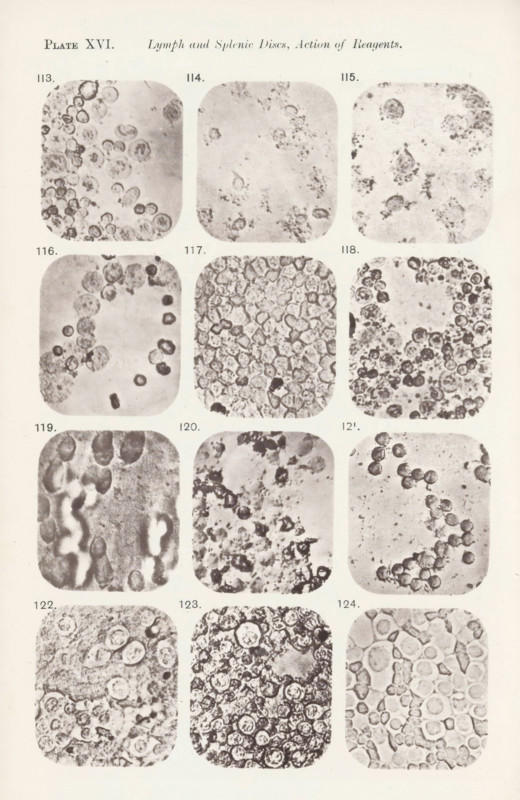 Twelve enlargements of the effects of saline solution on lymphocytes, page, photomechanical print, number: 'Pl. XVI.', number: 'Photo. 113., Photo. 124.', photographer: Richard Norris, clichémaker: anonymous, c. 1872 - in or before 1882, paper, collotype, light print, height 213 mm x width 135 mm, Page opposite page 219., blood, A vertical page with a grid of rounded square photographic panels arranged in columns and rows, each panel showing close-up grayscale images of clustered circular and irregular cellular shapes and textures; the panels vary in density and contrast with some showing dense packed circular units, others showing scattered small specks and faint outlines, and several panels displaying ring-like forms and darker centers; faint numbering appears near each panel but no letters or readable words are described; the page background is pale with a narrow border around the panels.