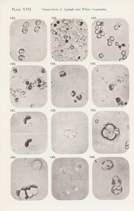 Twelve enlargements of white blood cells, page, photomechanical print, number: 'Pl. XVII.', number: 'Photo. 125., Photo. 136.', photographer: Richard Norris, cliché maker: anonymous, c. 1872 - in or before 1882, paper, collotype, photoprint, height 213 mm x width 135 mm, Page opposite page 221., blood, A vertical sheet showing a grid of rounded square panels arranged in columns, each panel containing circular and irregular dark and light cellular shapes on a pale background; the top has a centered heading area and there are small numeric labels near many panels, while individual panels display clusters of ringed circles, solid dark blobs, and faint granular textures with some panels showing paired darker crescent shapes and others showing dispersed speckled fragments.