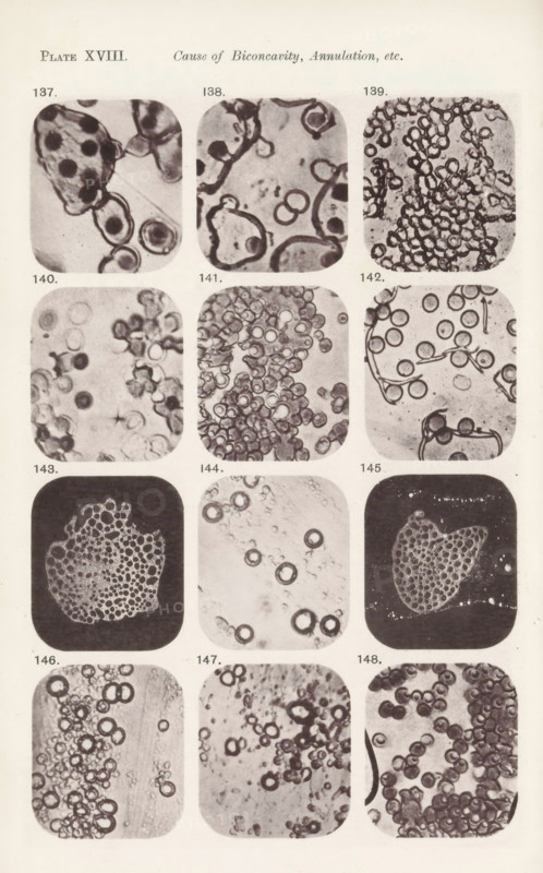 Twelve magnifications of blood corpuscles and myelin, page, photomechanical print, number: 'Pl. XVIII.', number: 'Photo. 137., Photo. 148.', photographer: Richard Norris, cliché maker: anonymous, c. 1872 - in or before 1882, paper, collotype, photoprint, height 213 mm x width 135 mm, Page opposite page 223., blood, A vertical page showing a grid of rounded square photographic panels arranged in columns and rows, each panel containing close-up monochrome images of circular and ring-like shapes that resemble cells or bubbles in various groupings and patterns; some panels show dense clusters, others show scattered rings, some include irregular dark outlines and overlapping circles, and a few panels have darker backgrounds contrasting with the lighter ring structures; the page has margins and small printed numbers near each panel.