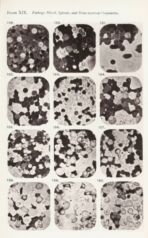 Twelve enlargements of blood cells from an embryo, page, photomechanical print, number: 'Photo. 149., Photo. 160.', number: 'Pl. XIX.', photographer: Richard Norris, clichémaker: anonymous, c. 1872 - in or before 1882, paper, collotype, light print, height 213 mm x width 135 mm, Page opposite page 224., blood, A vertical page with a printed title at the top and a grid of rounded-rectangle black-and-white microscopic images arranged in columns and rows, each image showing densely packed circular and irregular cell-like shapes with varying shades of gray and dark centers; small numeric labels appear above or beside each rounded image; the top left corner has a plate notation and a short italicized header; the overall page shows a pale background with slight texture and margins around the grid.
