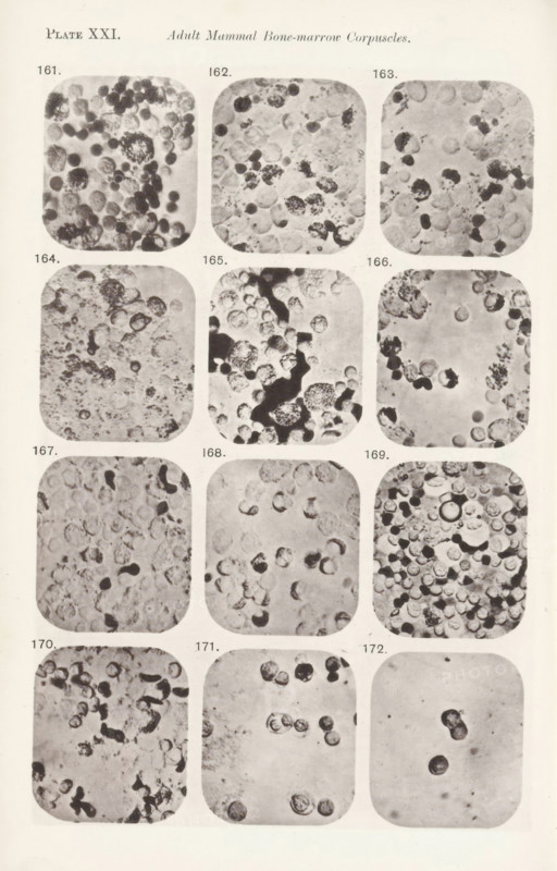 Twelve magnifications of blood corpuscles in a bone marrow, page, photomechanical print, number: 'Pl. XXI.', number: 'Photo. 161., Photo. 172.', photographer: Richard Norris, cliché maker: anonymous, c. 1872 - in or before 1882, paper, collotype, photoprint, height 213 mm x width 135 mm, Page opposite page 227., blood, A vertical sheet with a grid of rounded rectangular photographic panels arranged in columns and rows, each panel showing close-up grayscale images of circular and irregular cellular shapes with varying densities and dark spots, some panels containing clusters of small dark round forms while others show larger pale circular forms and scattered granular textures, the panels separated by light margins and arranged symmetrically across the page with pale background surrounding them.